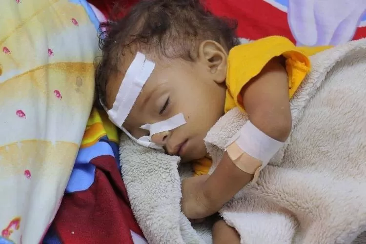 اليمن: الأمم المتحدة تحذر من تفشي مرض "شلل الأطفال" وتحمل الحوثيين المسؤولية